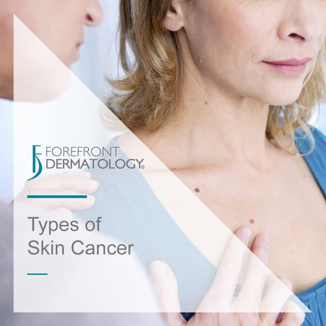 types of skin cancer