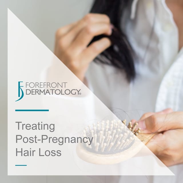 Post Pregnancy Hair Loss