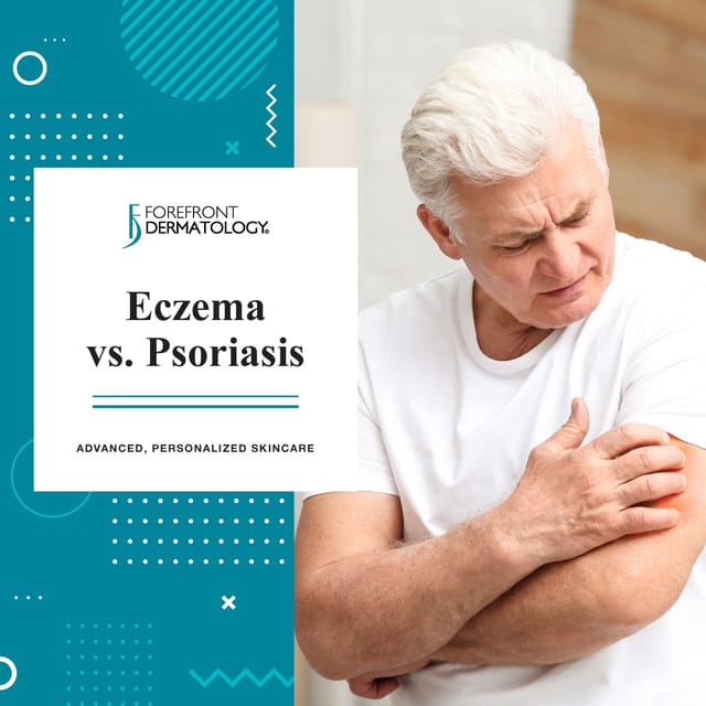 ECZEMA VS PSORIASIS