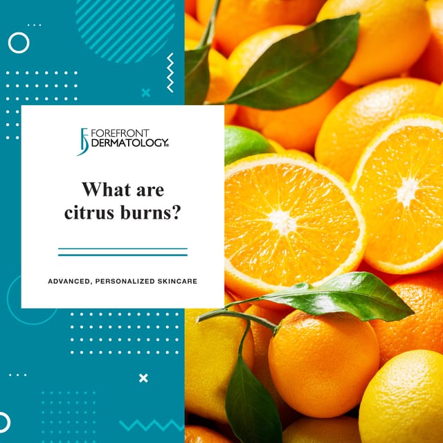 what are citrus burn