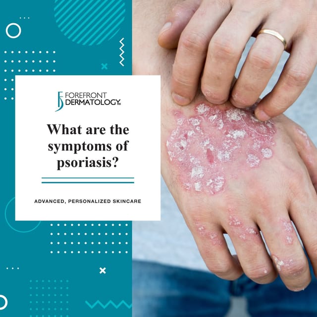 Psoriasis symptoms
