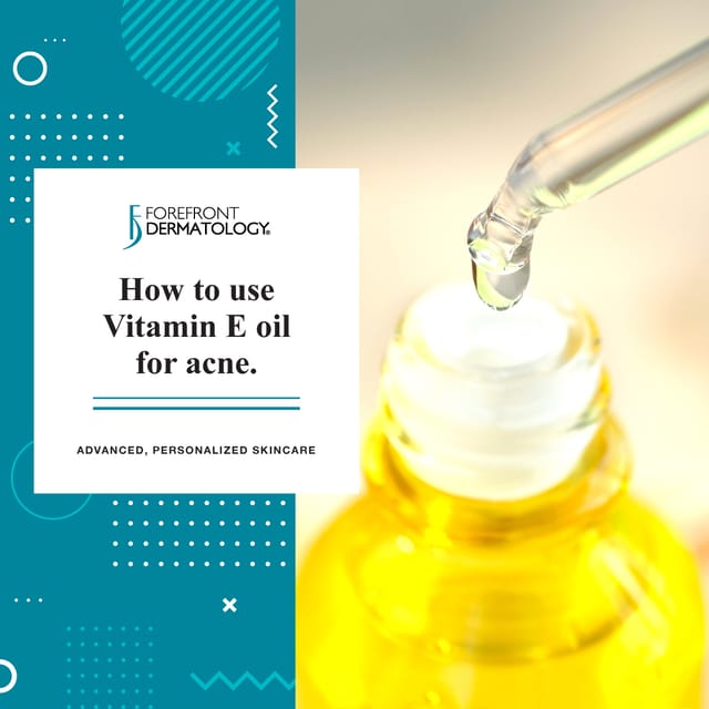 How to use vitamin E oil for acne