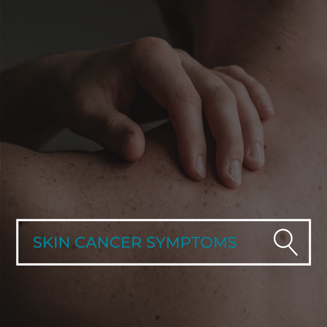 How Do You Know If You Have Skin Cancer?