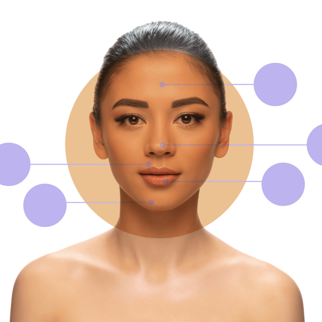 Acne Hack with Acne Mapping