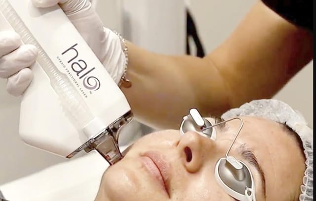Halo® Laser