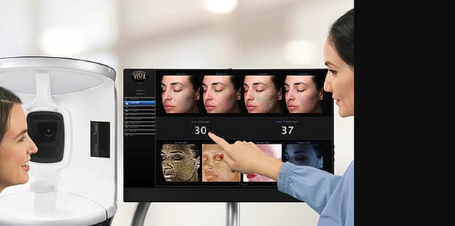 Visia Analysis®