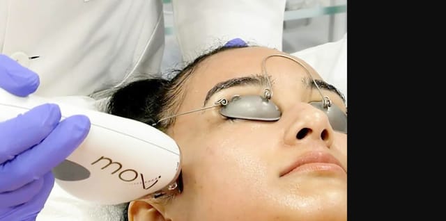 Sciton® MOXI™ Laser
