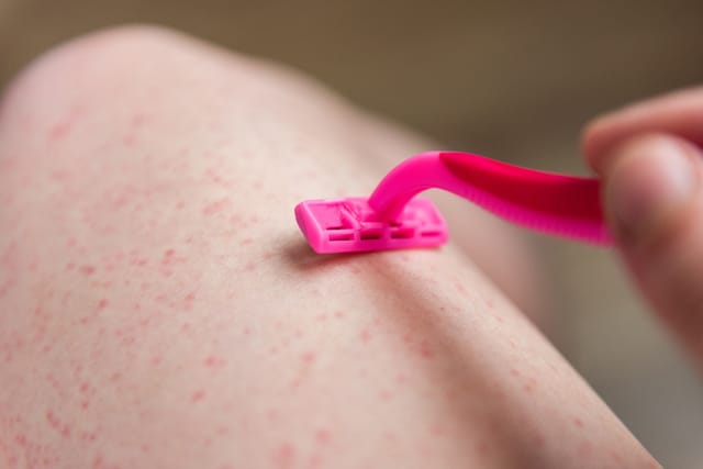 Legs with irritated razor bumps after shaving