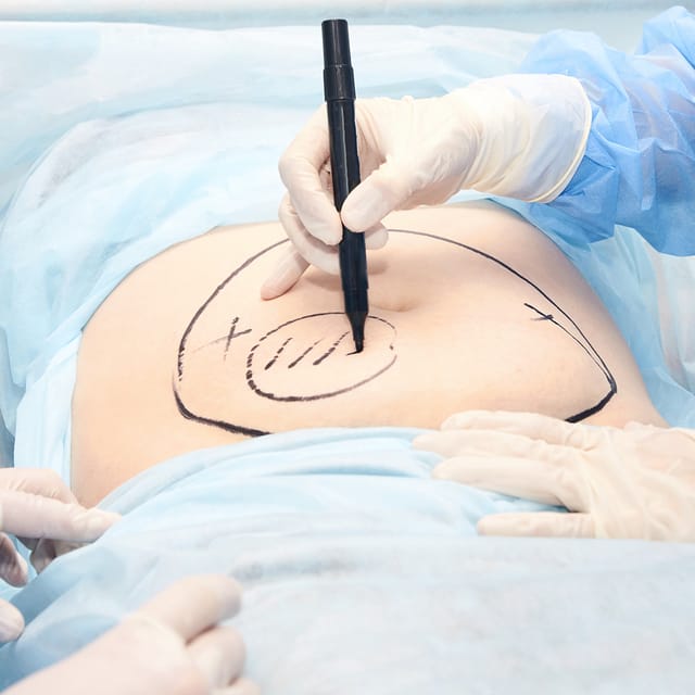 Surgical Body Procedures