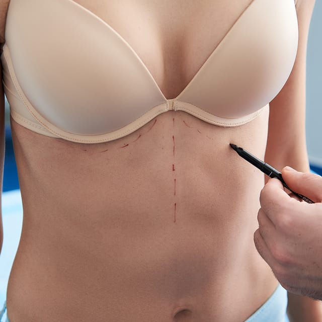 Breast revision surgery