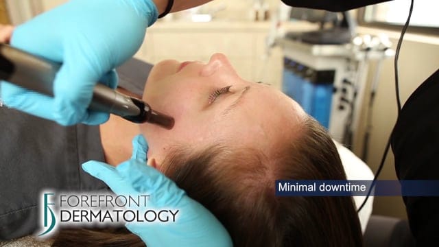 Learn about Microneedling