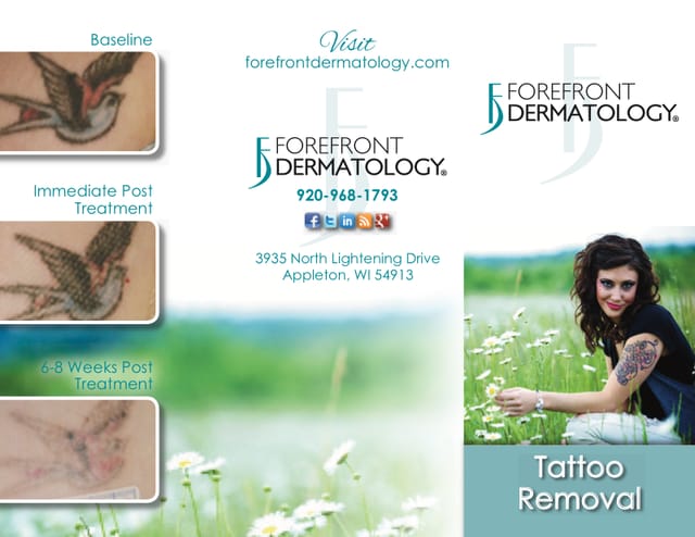 brochure-tattoo-removal-thumb
