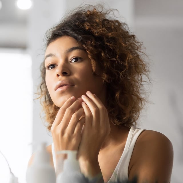 Melasma