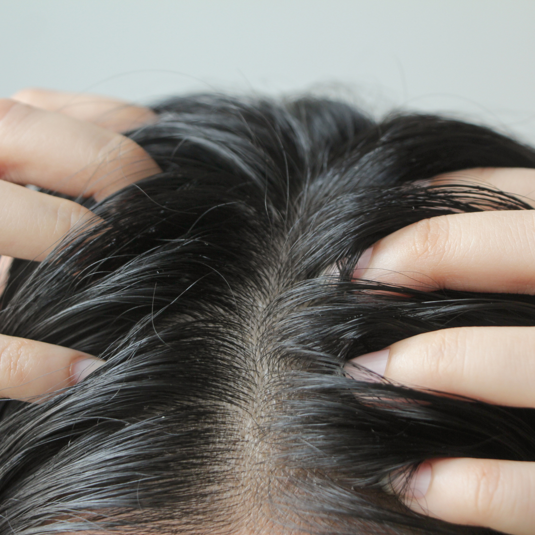 6 Common Causes of Itchy Scalp