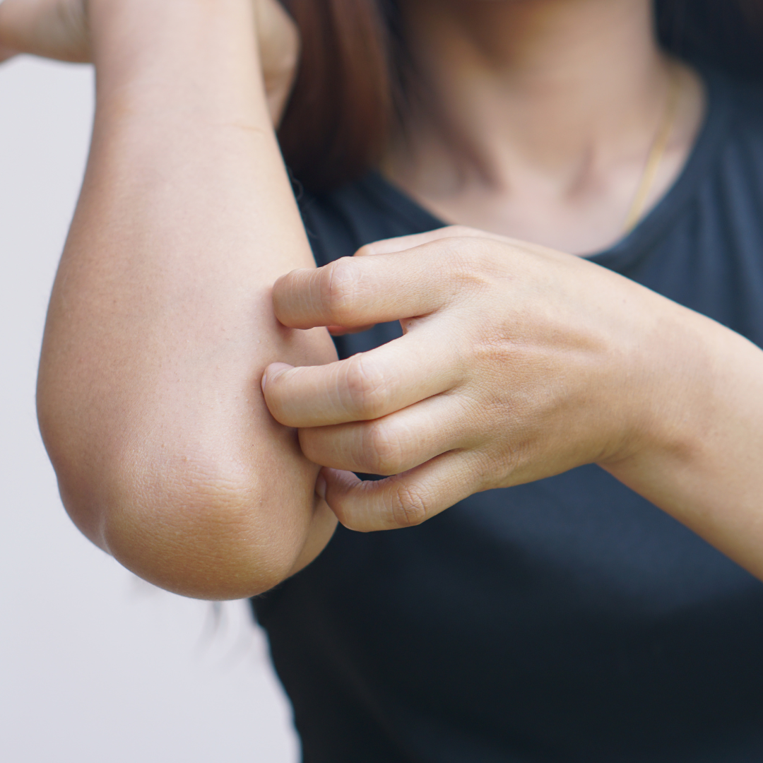 Causes of Itching Without a Rash