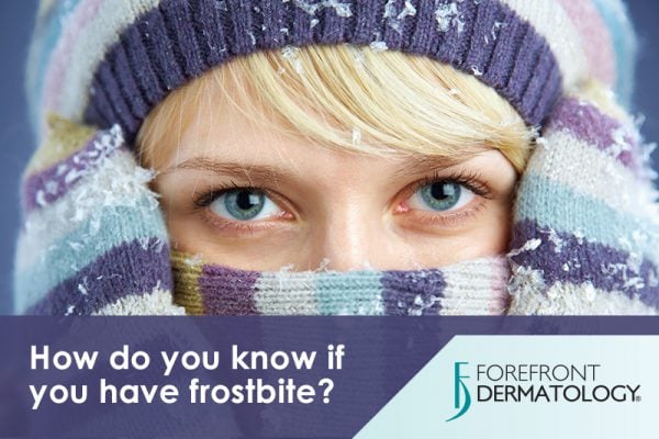 How to Tell if You Have Frostbite (And What to Do About It)