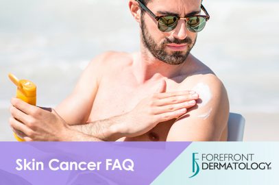 Skin Cancer FAQ