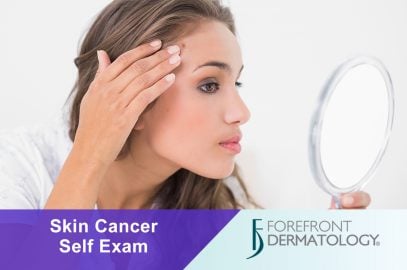How to Perform a Monthly Skin Cancer Self-Examination