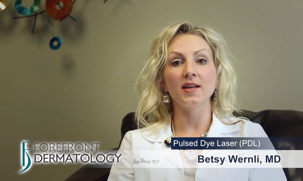 Dr. Betsy J. Wernli on Pulsed Dye Laser