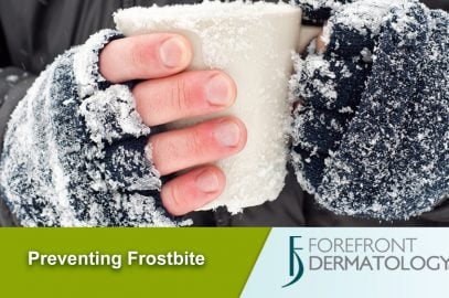 Protecting Yourself and Your Family from Frostbite