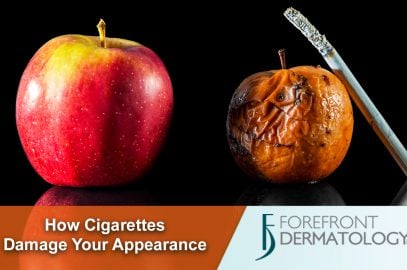 Smoking and the Skin: How Cigarettes Damage your Appearance