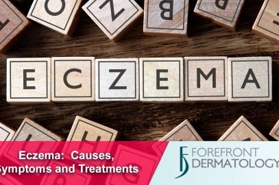 About Eczema: Causes and Symptoms