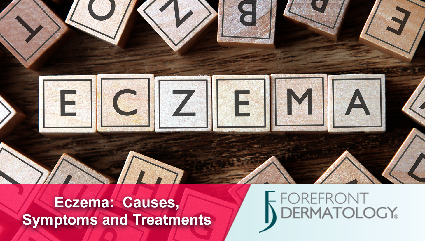 About Eczema: Causes and Symptoms