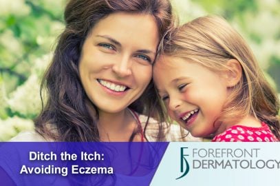 Ditch the Itch: Treating Eczema