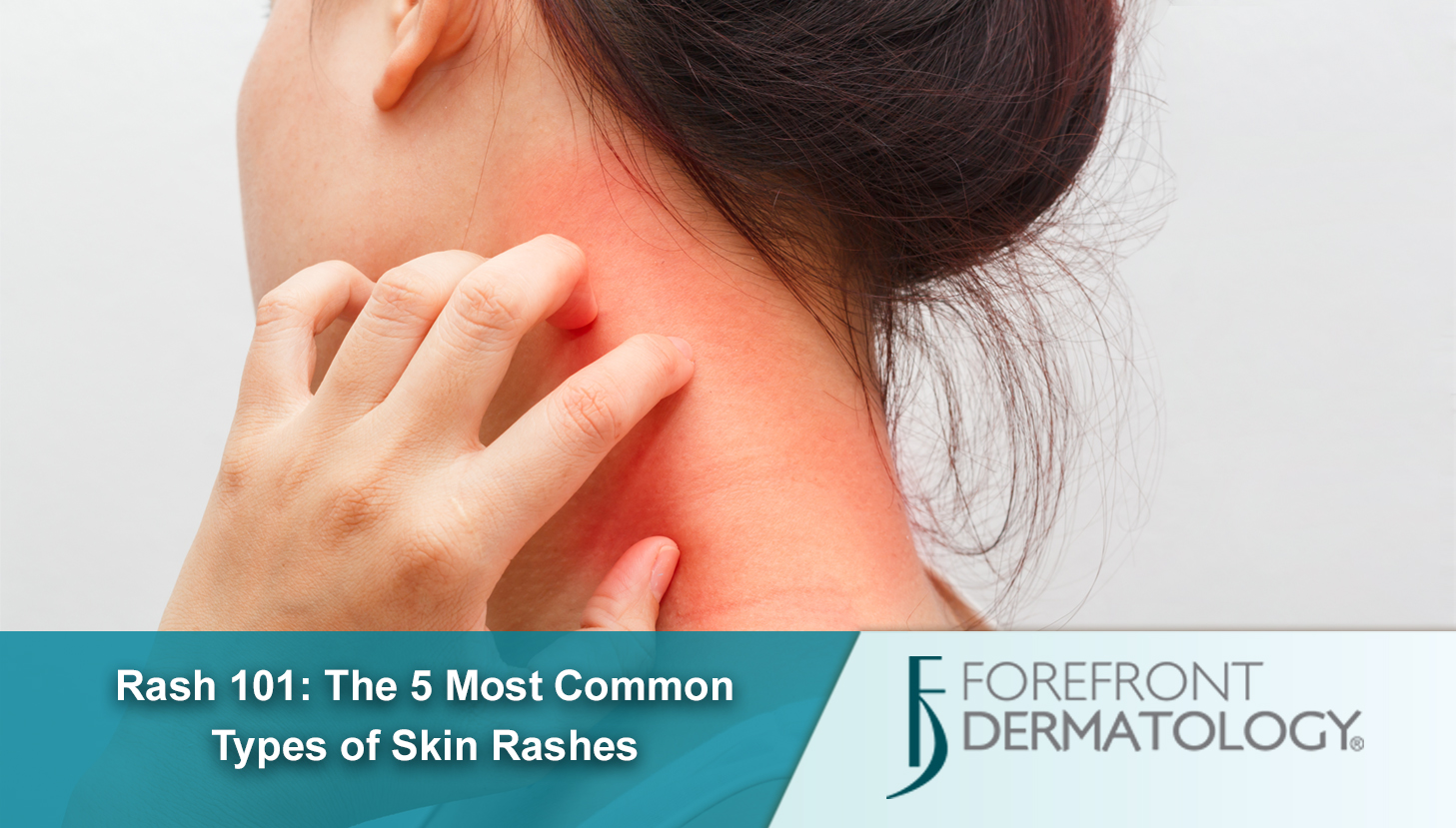 Skin Rashes On Neck