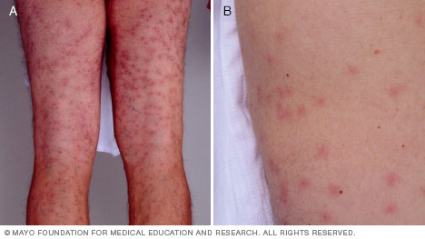 How can you tell if a skin rash is serious? - Westchester Dermatology  Medical Clinic