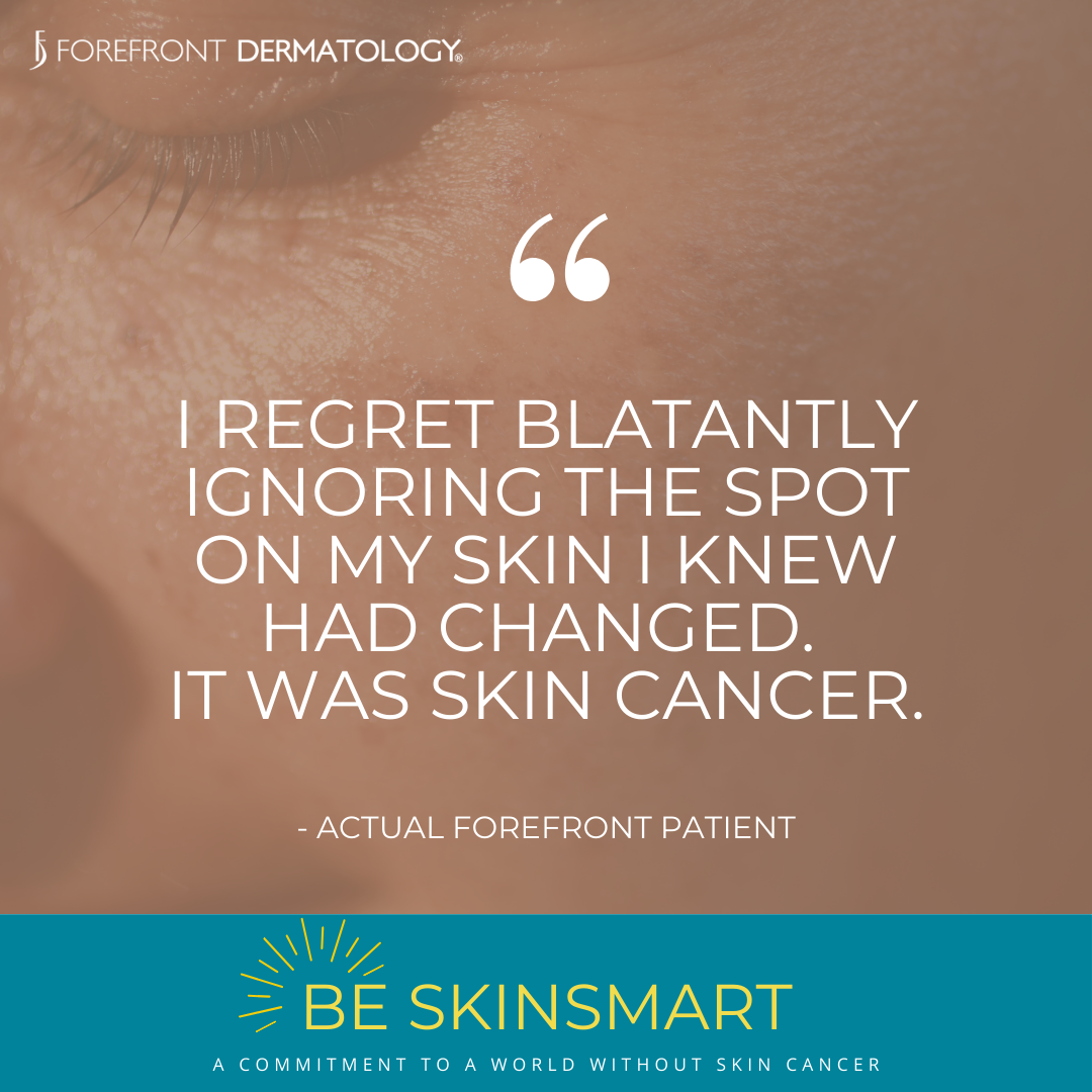 How to Perform a Self-Skin Check