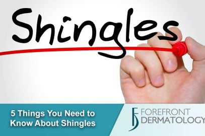 5 Things You Need to Know About Shingles