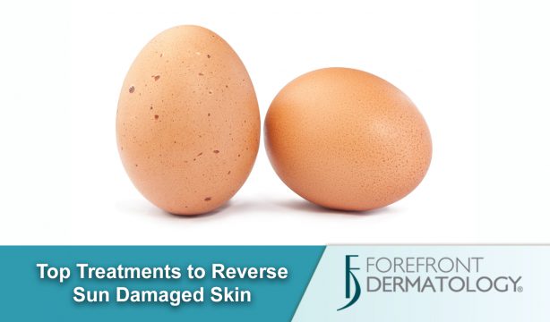 Top 3 Treatments to Reverse UV Damage
