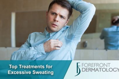 Top Treatments for Excessive Sweating