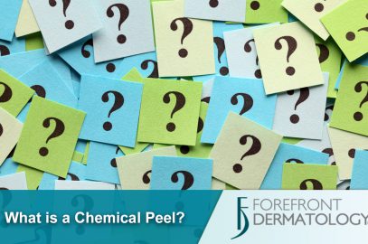 What is a Chemical Peel?