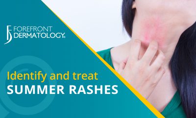 How to Identify and Treat Summer Skin Rashes