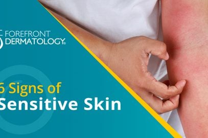 6 Signs You Have Sensitive Skin