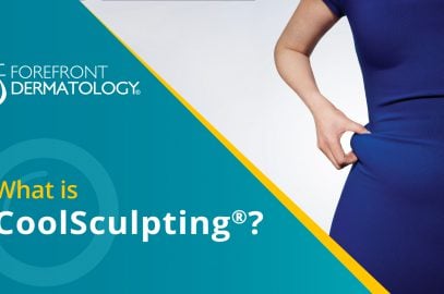 What is CoolSculpting®?