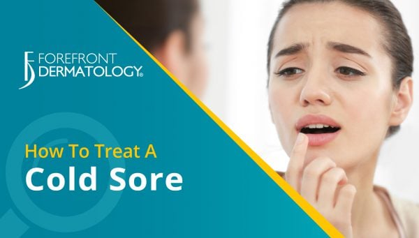 How to Treat a Cold Sore