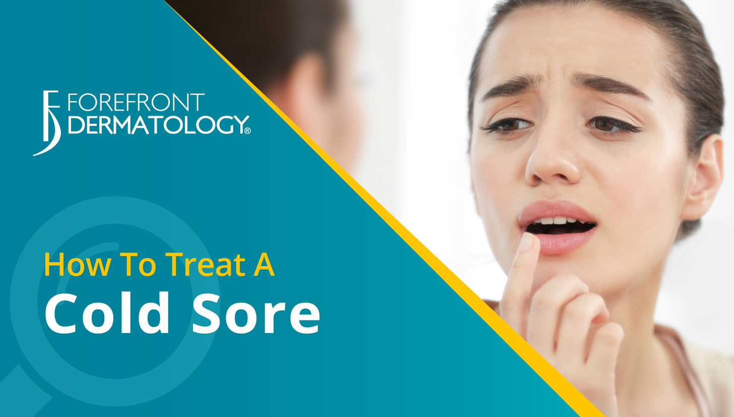 How to Treat a Cold Sore Forefront Dermatology