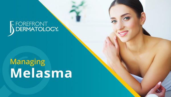 Managing Melasma