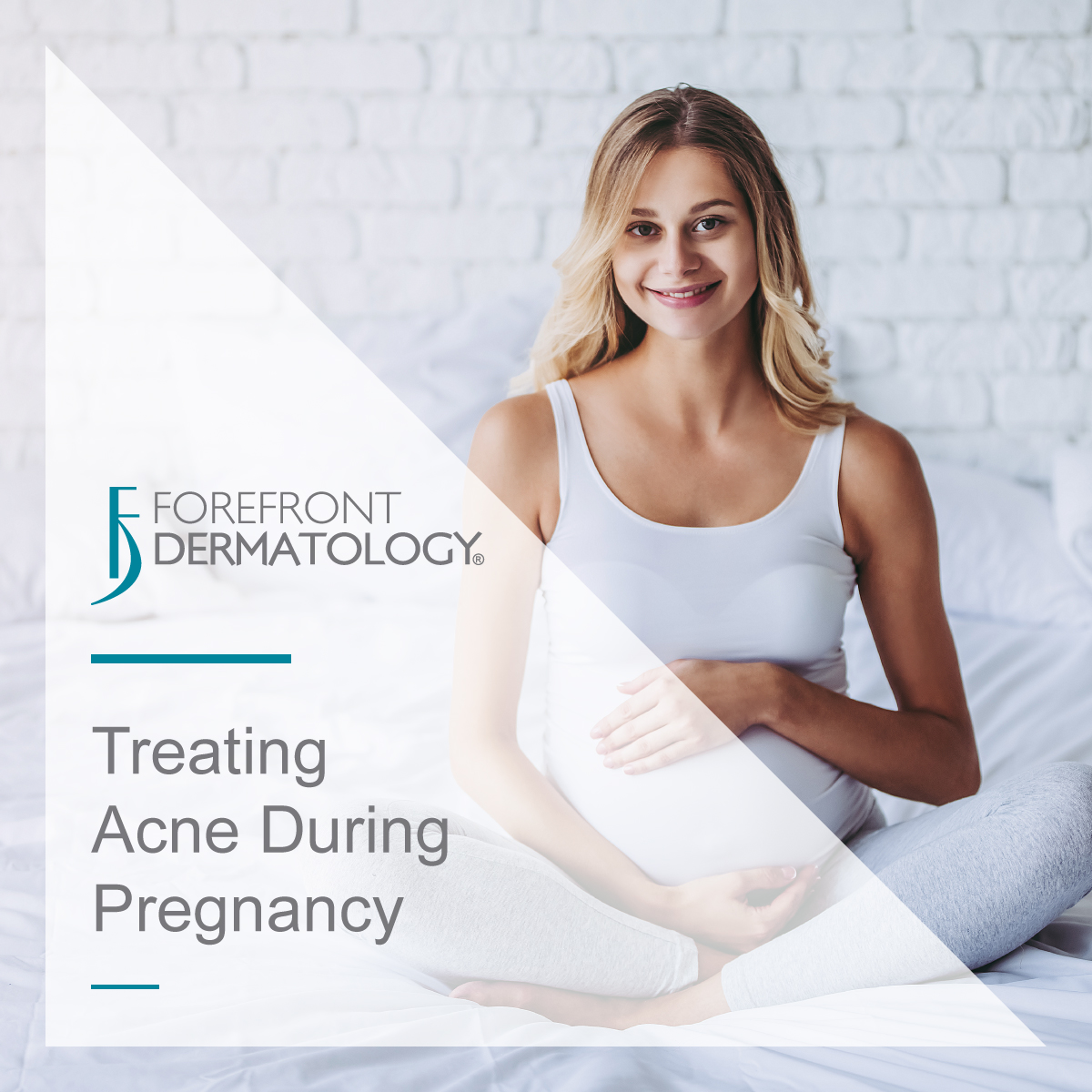 Treating Acne While Pregnant