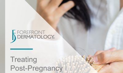 Treating Postpartum Hair Loss