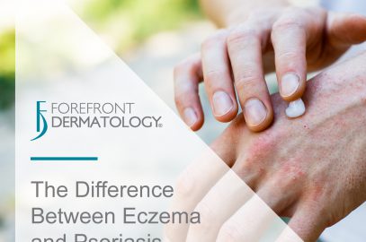The Difference between Eczema and Psoriasis