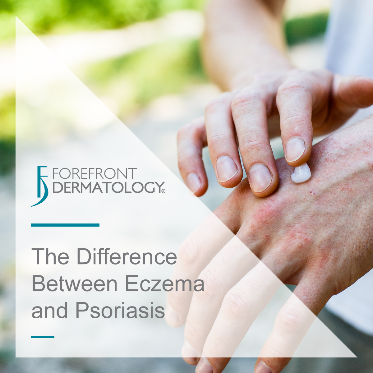 The Difference Between Eczema And Psoriasis - Forefront Dermatology