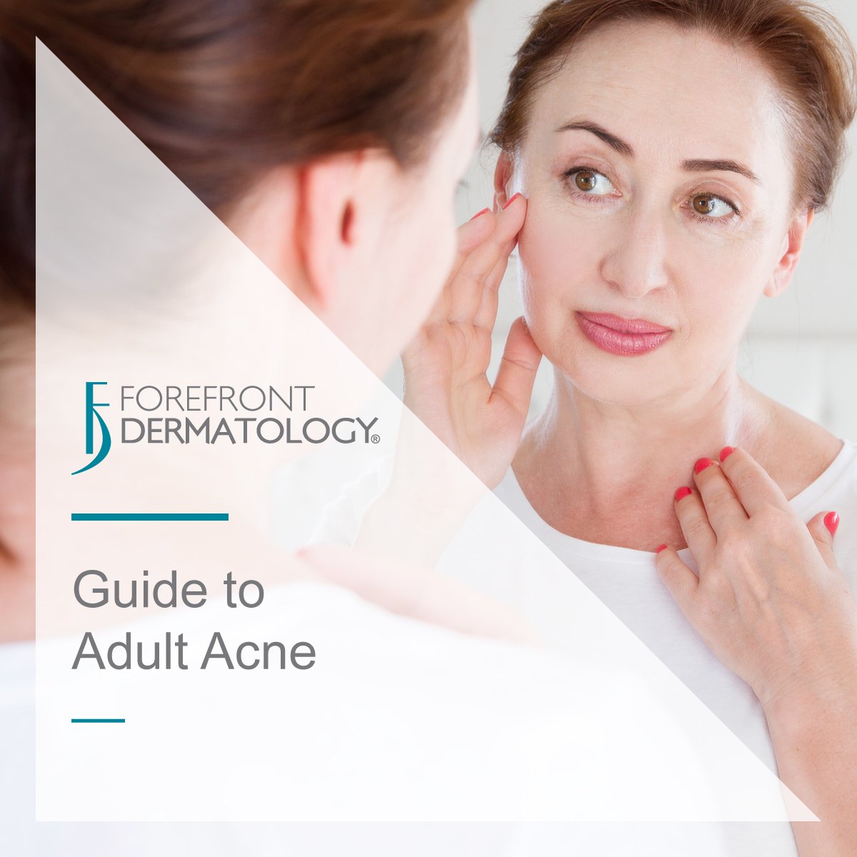 Guide To Adult Acne Forefront Dermatology