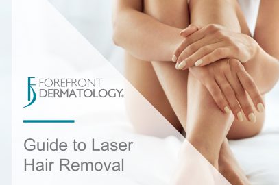 Guide to Laser Hair Removal
