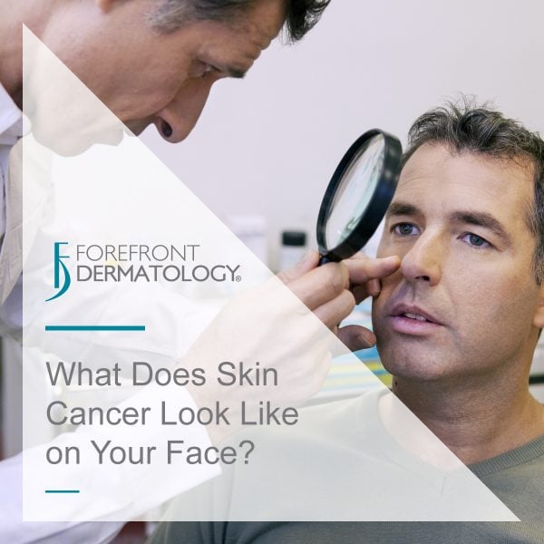What Does Skin Cancer Look Like on Your Face?