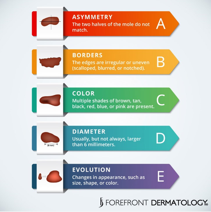 skin cancer chart