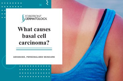 What Causes Basal Cell Carcinoma? | Forefront Dermatology